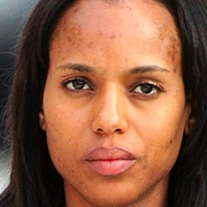 13 Celebrities With Bad Skin Problems That Will Surprise You - ZergNet