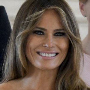 Melania Trumps Dramatic Transformation Cosmetic Surgery Or Natural Beauty - cs2la9p