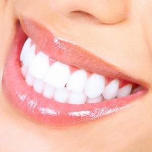 strongest teeth whitening gel