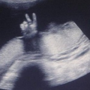 Funny & Amazing Ultrasound Photos - ZergNet