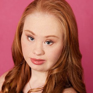 Model Who Won't Let Down Syndrome Stop Her - ZergNet
