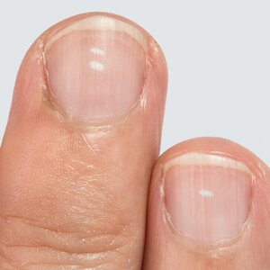 If You Have Ridges On Your Fingernails It Means This - ZergNet